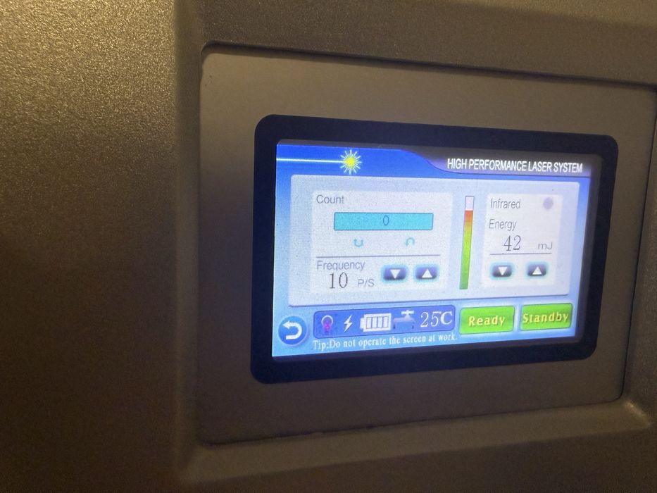Laser Nd Yag  remoção de tatuagem