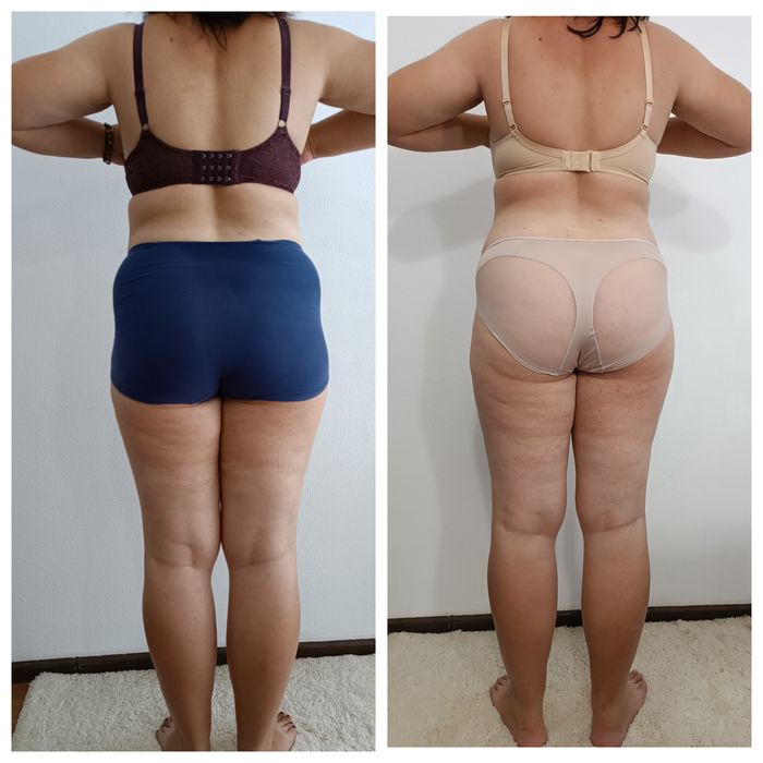 Масаж Шугаринг  Мукачево