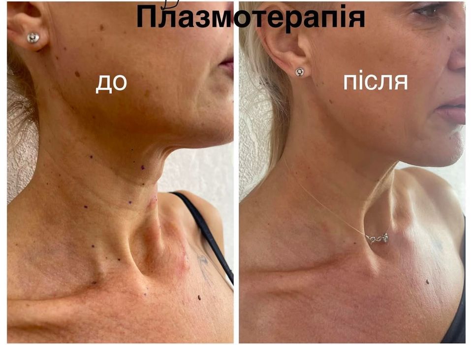 Косметолог, Київ, Лівий берег, Осокорки