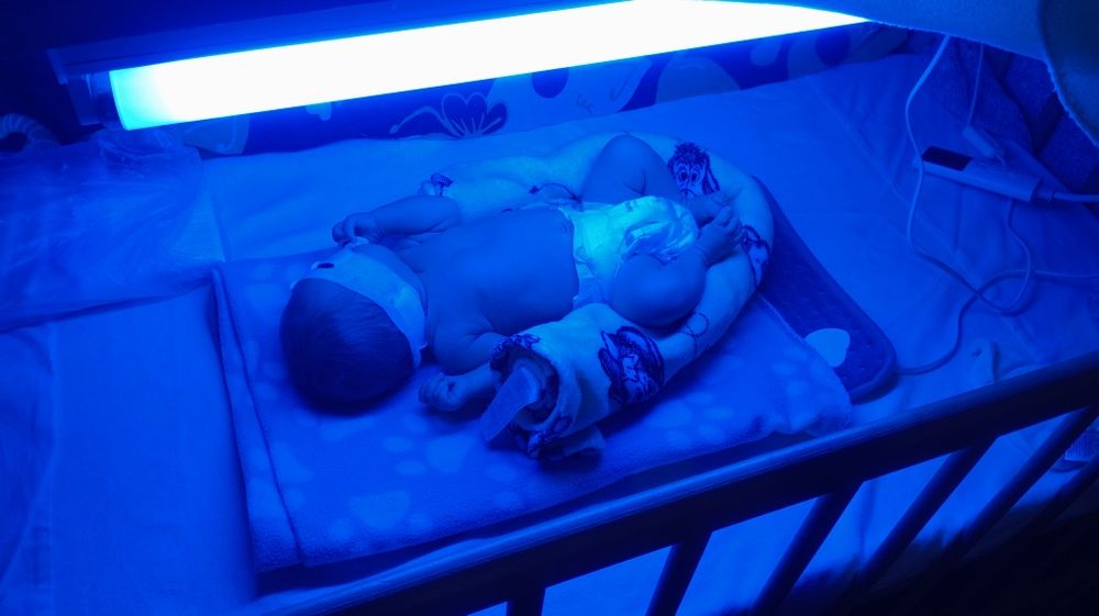 Лампа для жовтяниця новонароджених