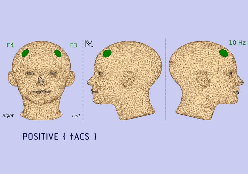 Электростимулятор «NEUROMYST PRO» tdcs тдкс tacs микрополяризация