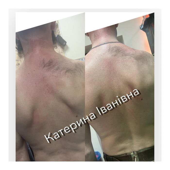 Масаж  та реабілітація!Стоун терапія лімфодренаж пресотерапія