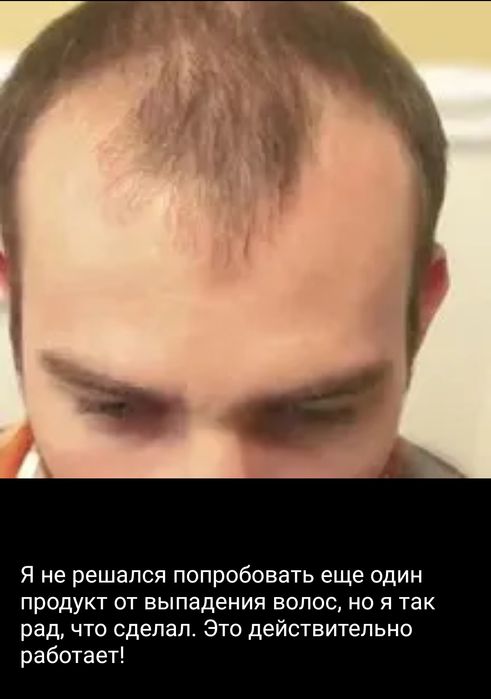 Сыворотка  для роста волос