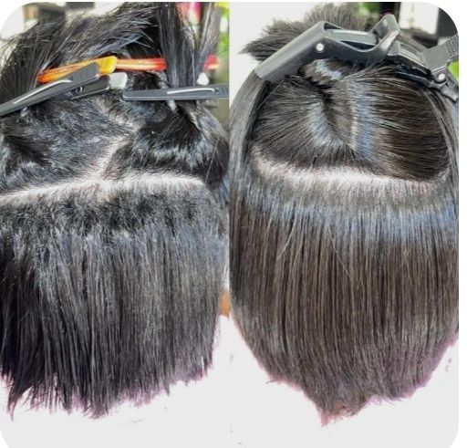 Ao Domicilio, Progressiva/fioterapia e alizamentos