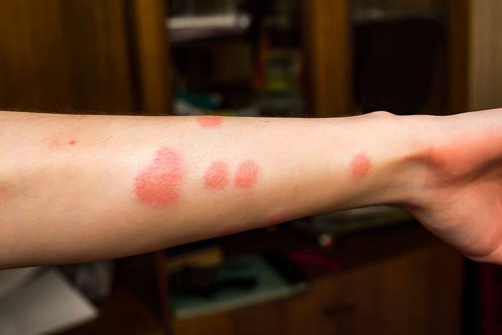 Уничтожение, тараканов, клопов, блох, Без запаха   ХОЛОДНЫЙ ТУМАНОМ