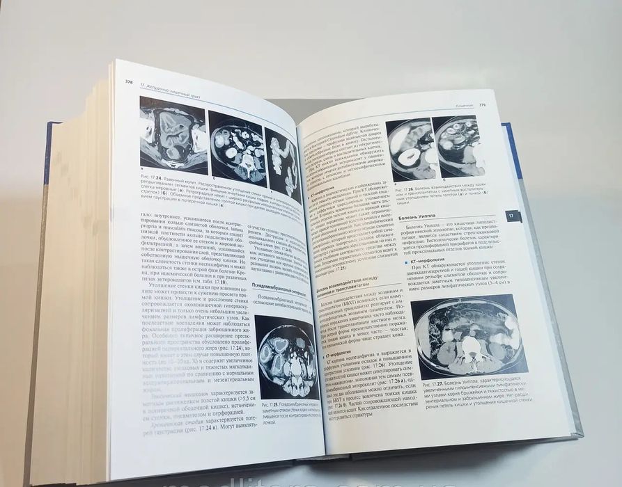 Прокоп М., Галански Спиральная и многослойная компьютерная томография.