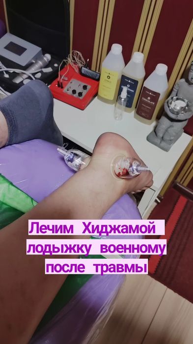 Обучение Хиджаме Харьков индивидуально и группой,  лично и онлайн