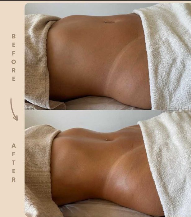 Formação estética