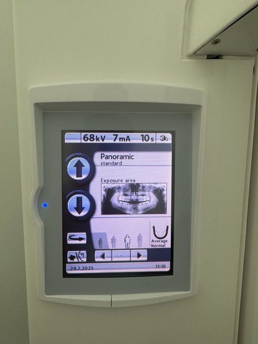 Ortopantomografo (rx panoramico)