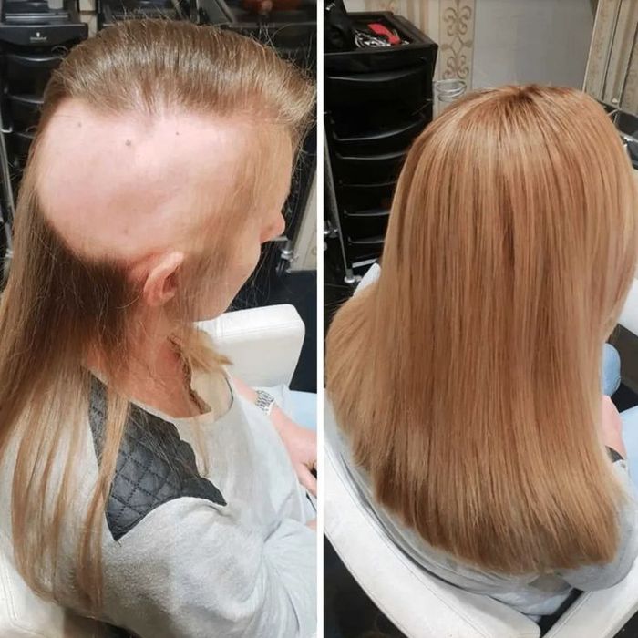 Curso Profissional de prótese capilar injetada em Alverca