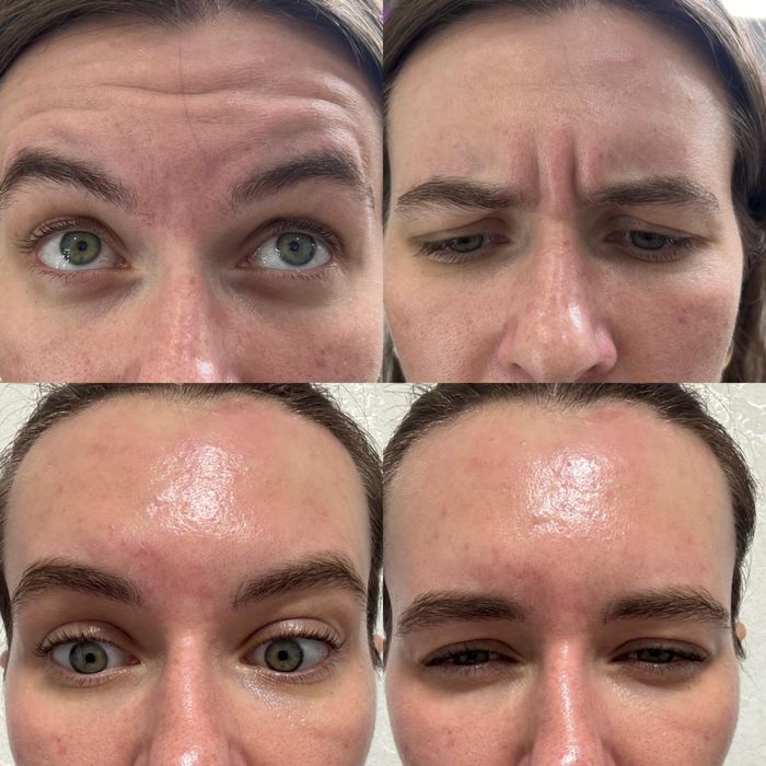 Лікар-Косметолог-Дерматолог Коммунарівський р-н,піски,4-й південний