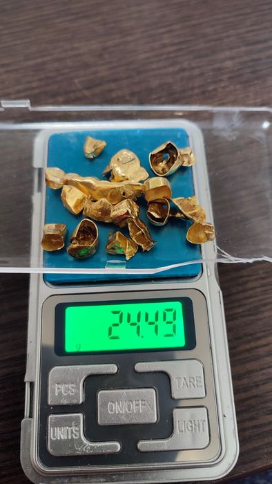 Зубные коронки золото 850 проба