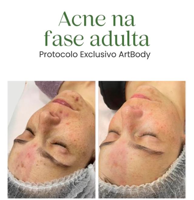 Ofereça massagem* costas em Santa Clara