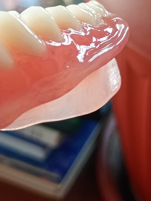 Стоматологія. Металокераміка, циркон, протези , пластмаса.