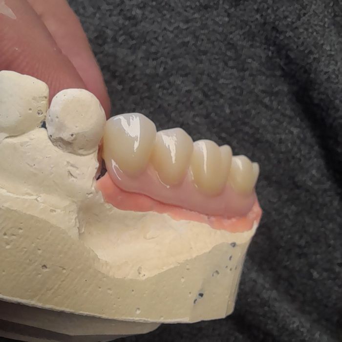 Зубний    технік