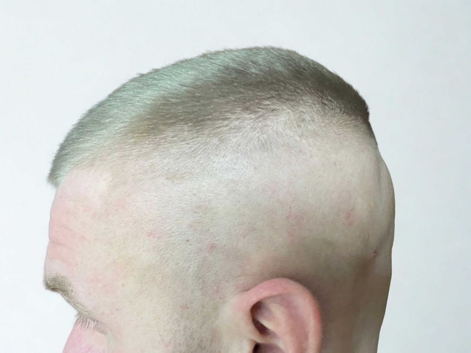 Darmowe Strzyżenie Męskie