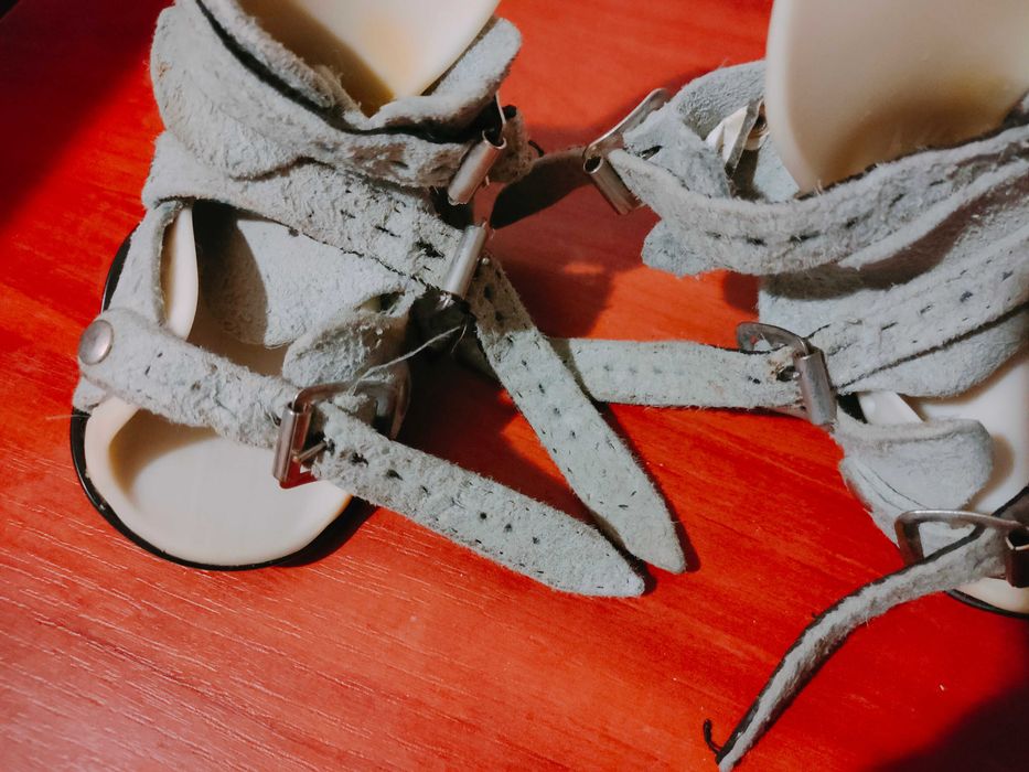 Брейсы "Митчелл"