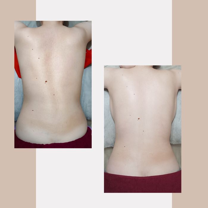 Лікувально-оздоровчий масаж. Реабілітаційний масаж. Кінезіотейпування