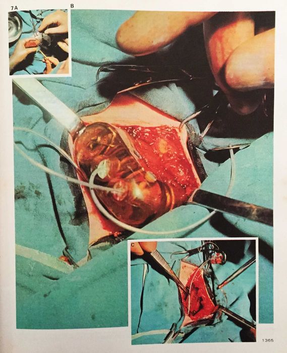 Coleção 'Enciclopédia de Medicina e Saúde"