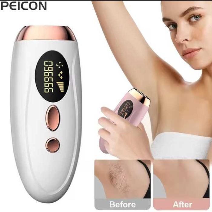 Профессиональный фотоепилятор лазерный эпилятор ipl епілятор