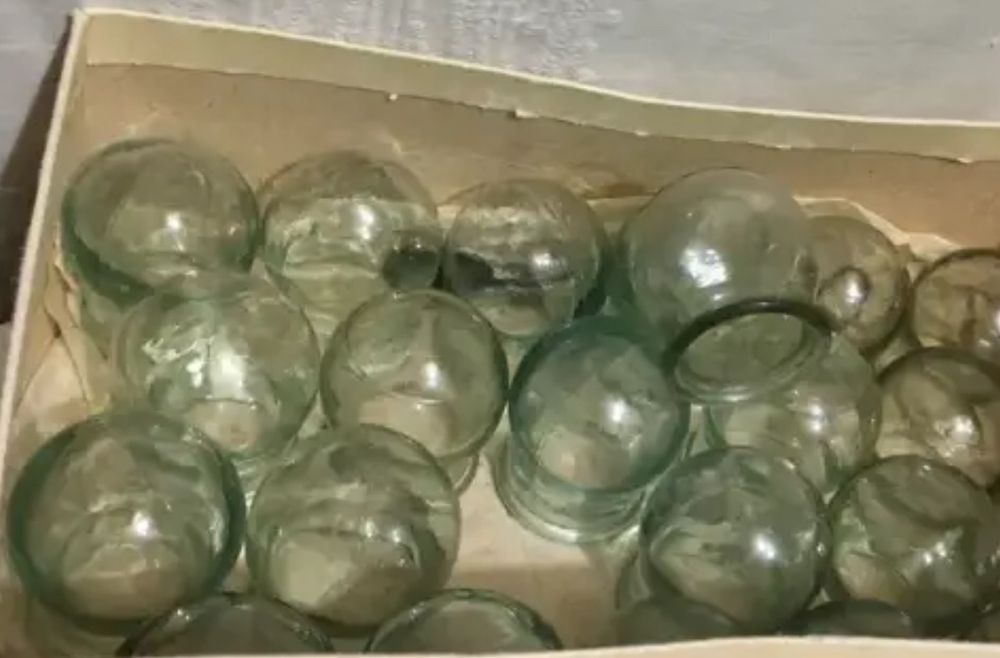 Банки медицинские 25 шт