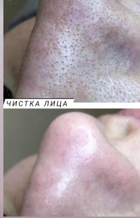 !Обучение косметолог - эстетист без мед образования !