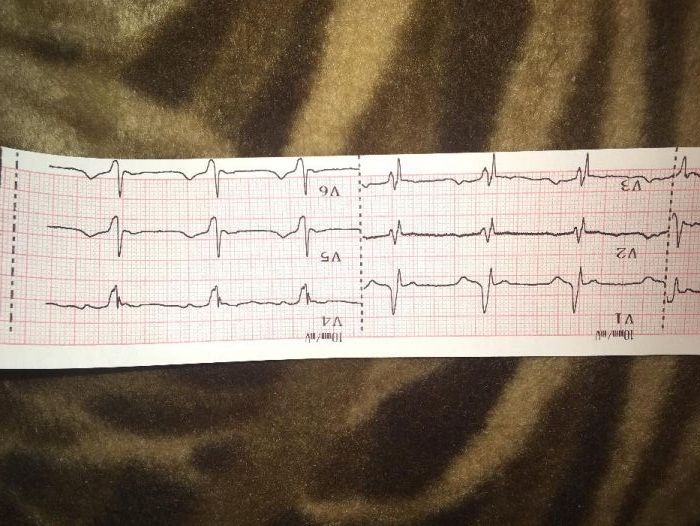 Кардиограмма на дому