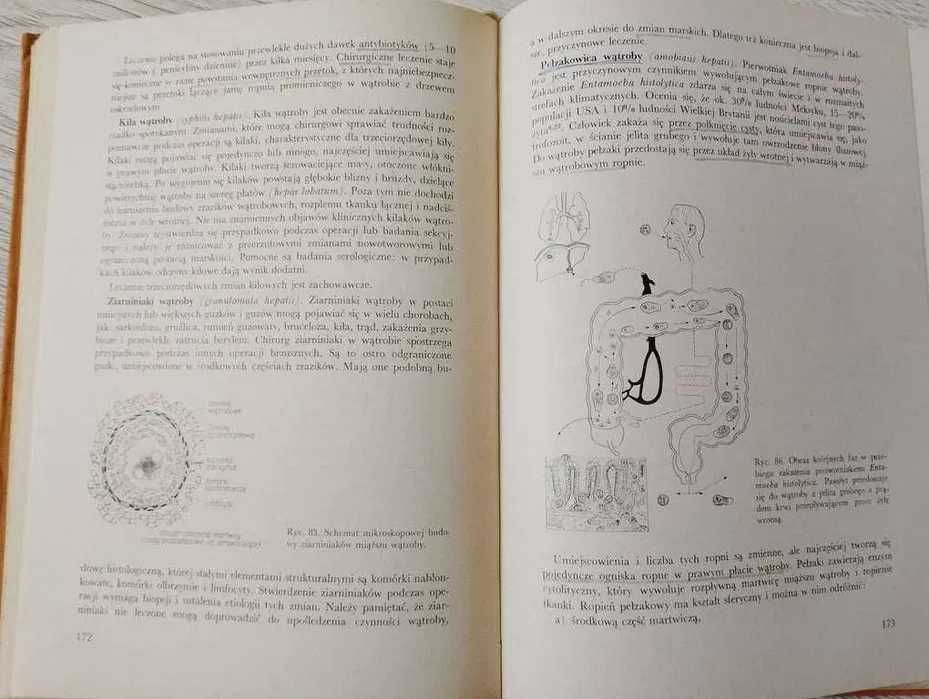 Chirurgia wątroby i dróg żółciowych red. J.Kubiak / MEDYCYNA