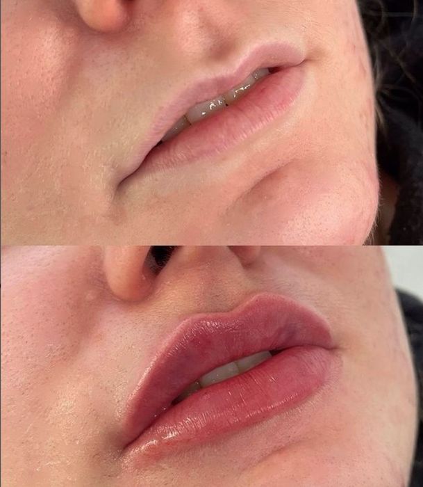 Косметолог.АКЦІЯ!м.Харківська