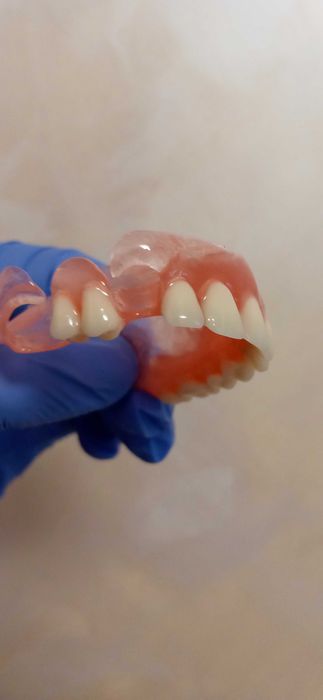 Proteza zębowa acronowa- elastyczna naprawa protez proteza bezklamrowa