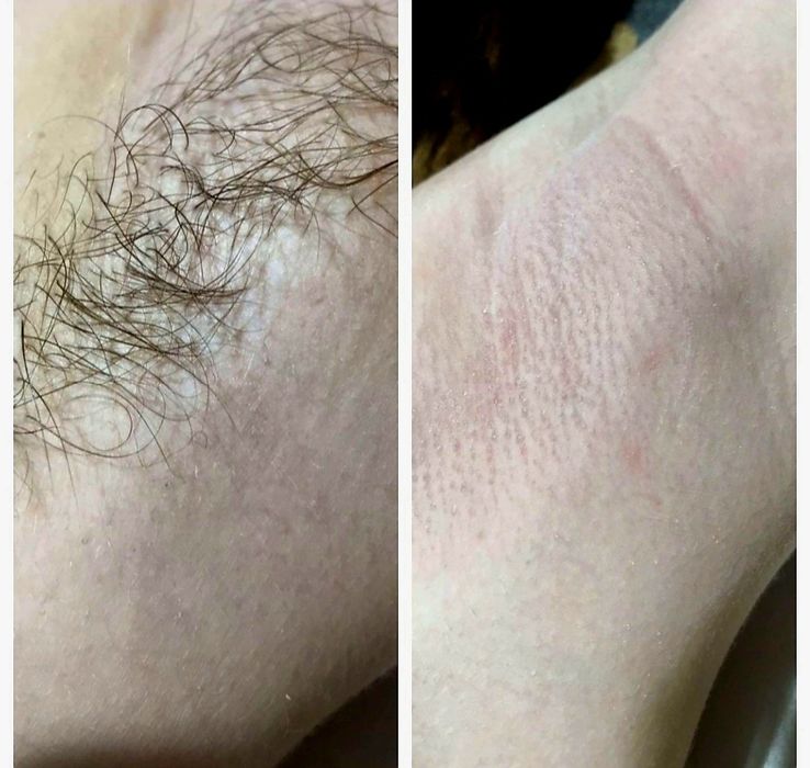 .ЖІНОЧА ВОСКОВА депіляція, Лівий берег. Чернігівська- Лісова. Працюю в