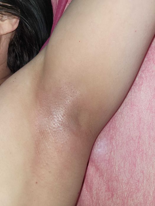 Депиляция/эпиляция жен/муж/подросток. Оформл. окраш. бровей.Черноморск