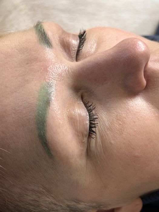 Видалення- лазером, ремууером. Татуаж, перманент або татуювання, видал