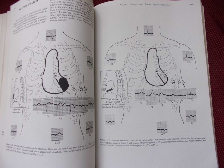 Principles of cliniical electrocadiography - wydanie 10 super stan