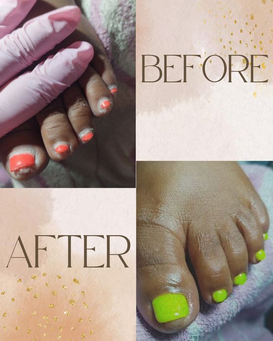 Estética Avançada (Micropigmentaçao Facial , Tratamento de estrias…)