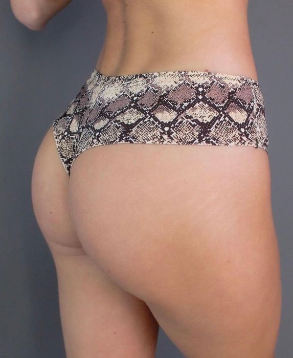 Найзручніша модель бразильян від Acousma трусики