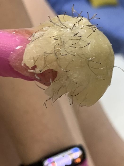 Депіляція для жінок і чоловіків, вагітних, підлітків