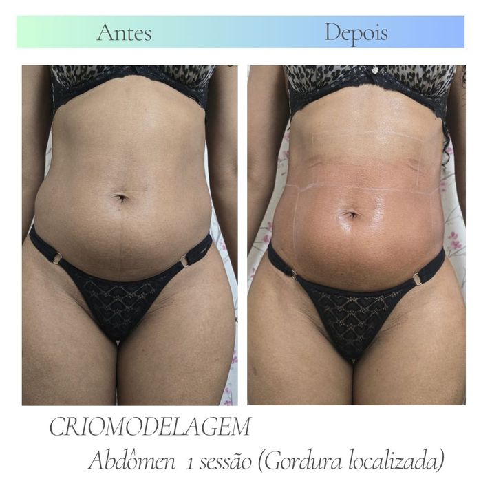 Massagem Terapêutica  e Estética avançada