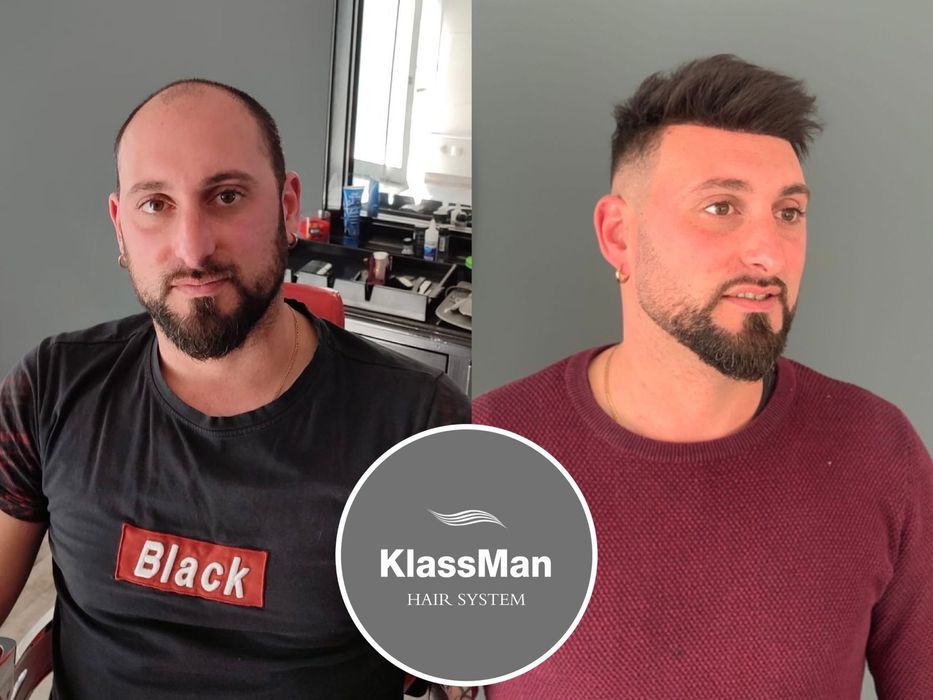 Nova Clinica KlassMan Lisboa Metro-Telheiras 1m. Porto Metro-Dragão 1m