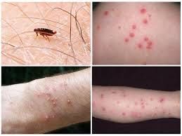 Уничтожение тараканов клопов блох ос шершн муравьев Знищення тарганів