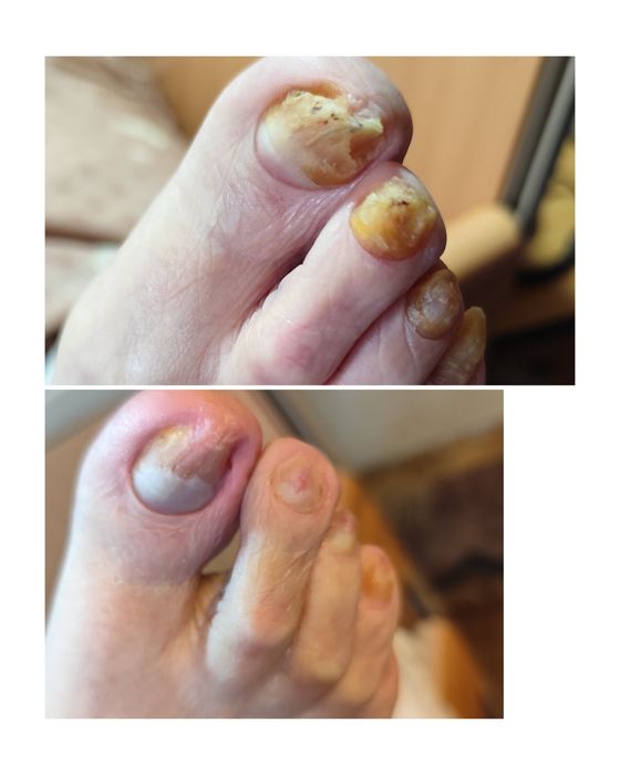 Podolog  mobilny, pedicure , manicure hybrydowy z dojazdem. Poznań. Luboń