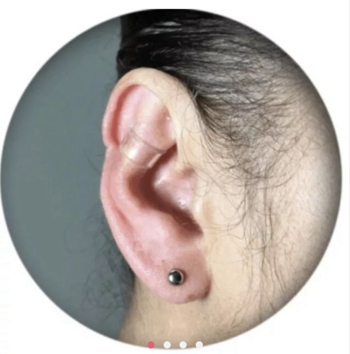 Vendo corretor de orelhas NOVO