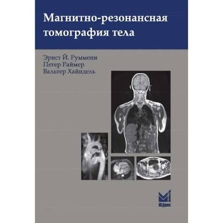 Посібник МРТ тіла