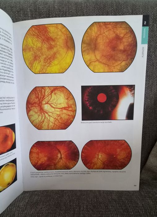 Atlas chorób siatkówki