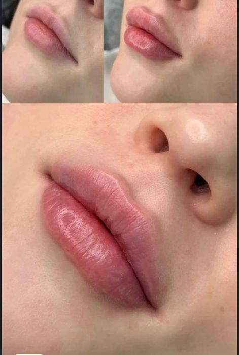 Косметолог Мукачево , по доступним цінам