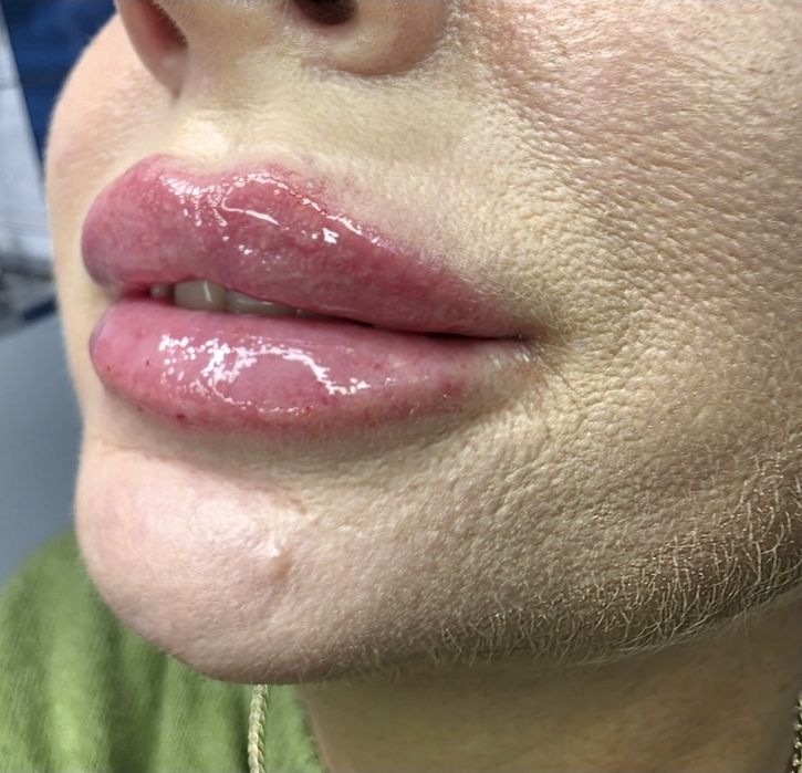 Promocja Borox 1 okolica 130zł