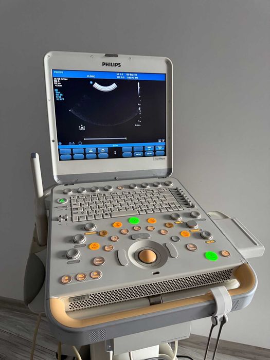 Апарат УЗД (УЗИ аппарат) PHILIPS CX-50