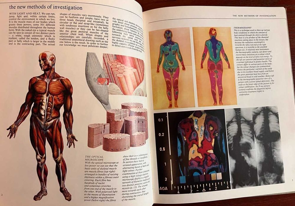 Оригинальное винтажное издание "Атлас анатомии The New Atlas of the Human Body" (1980) на английском