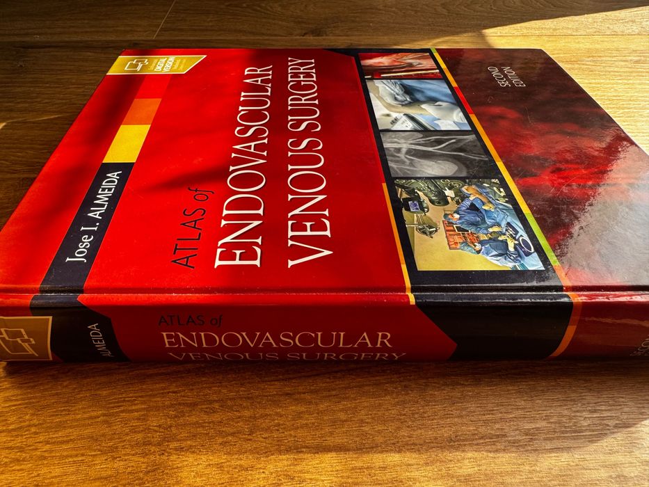Chirurgia naczyniowa - Atlas of Endovascular Venous Surgery
