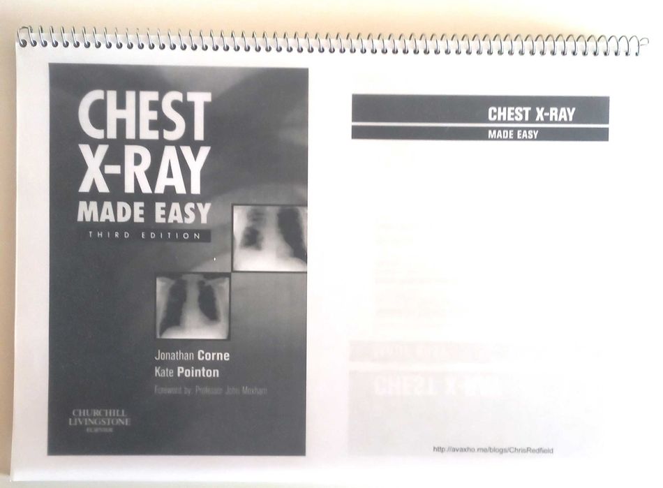 Chest X-Ray Made Easy, 3Ed